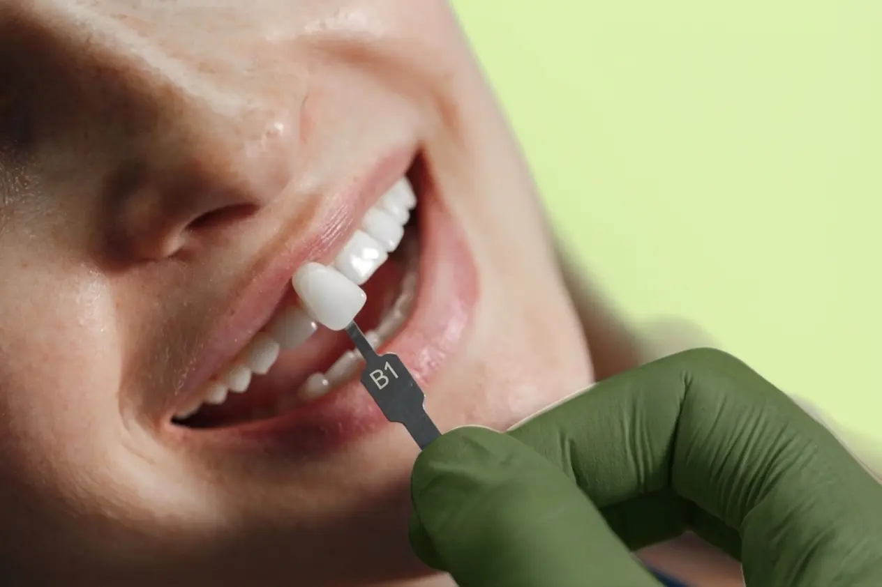 Dental treatment at OPAL Dental Group in Paramount, CA